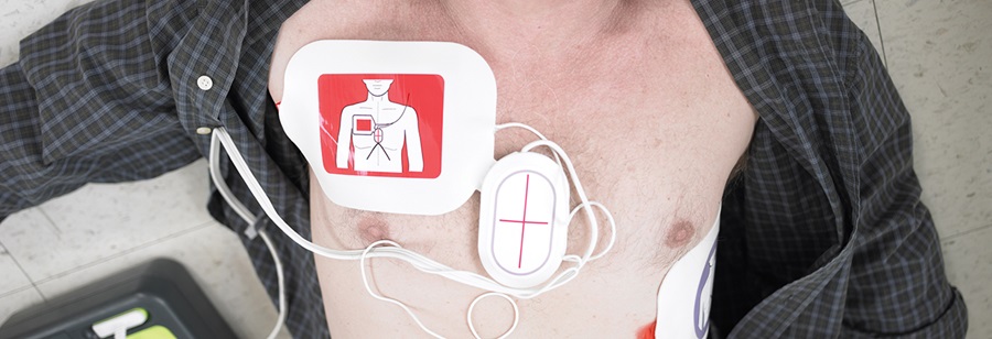 Electrodos para EMS